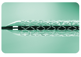 Coated Stent